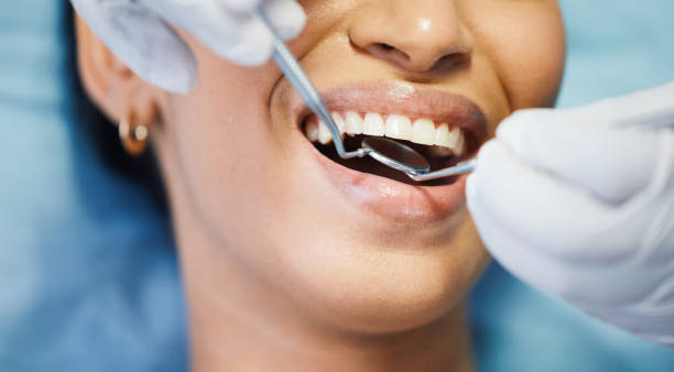 Best Broken or Cracked Tooth Emergency Dentist in Lockport, NY