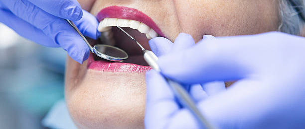 Best Emergency Dental Extractions in Lockport, NY